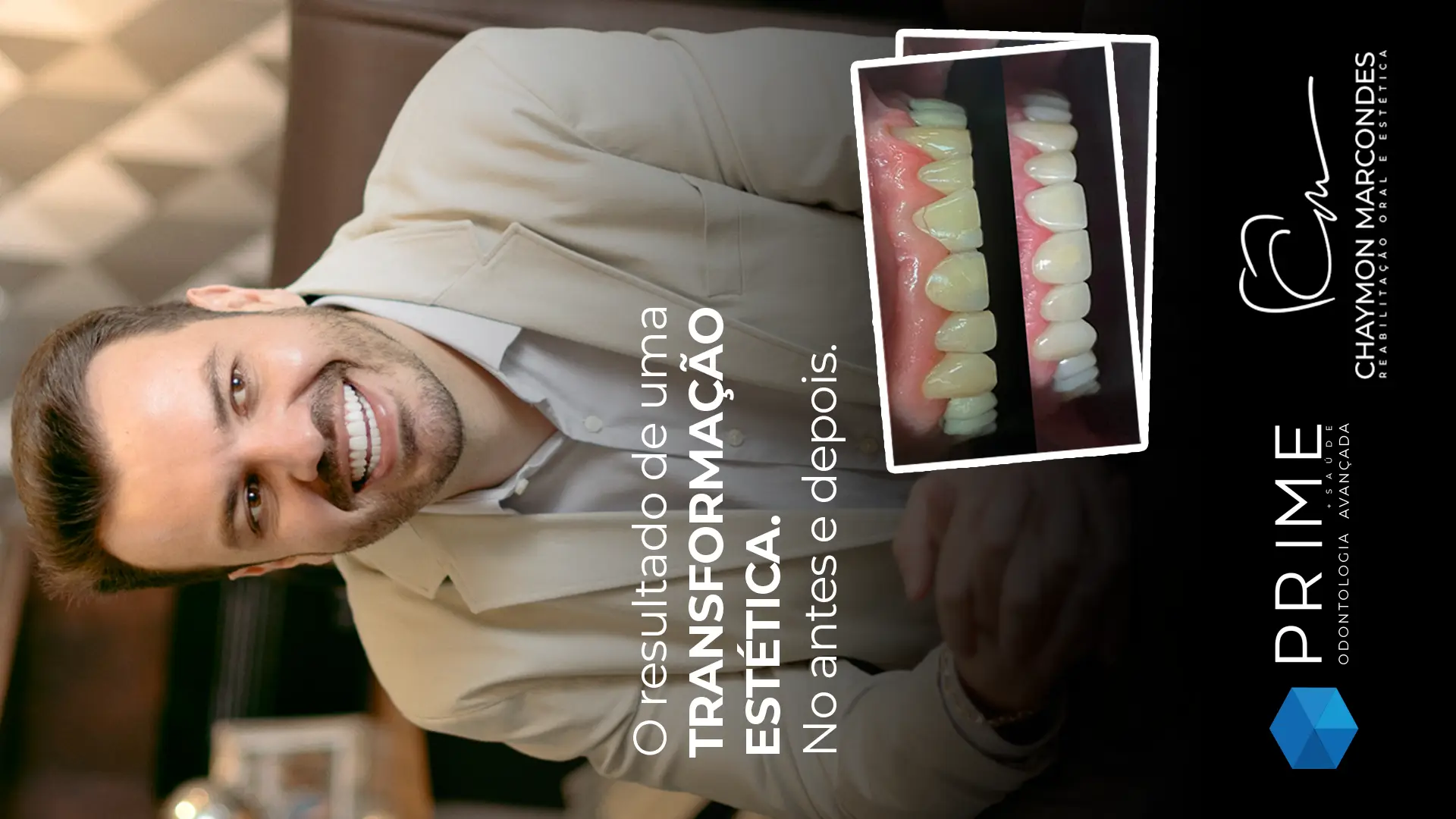 Transformação